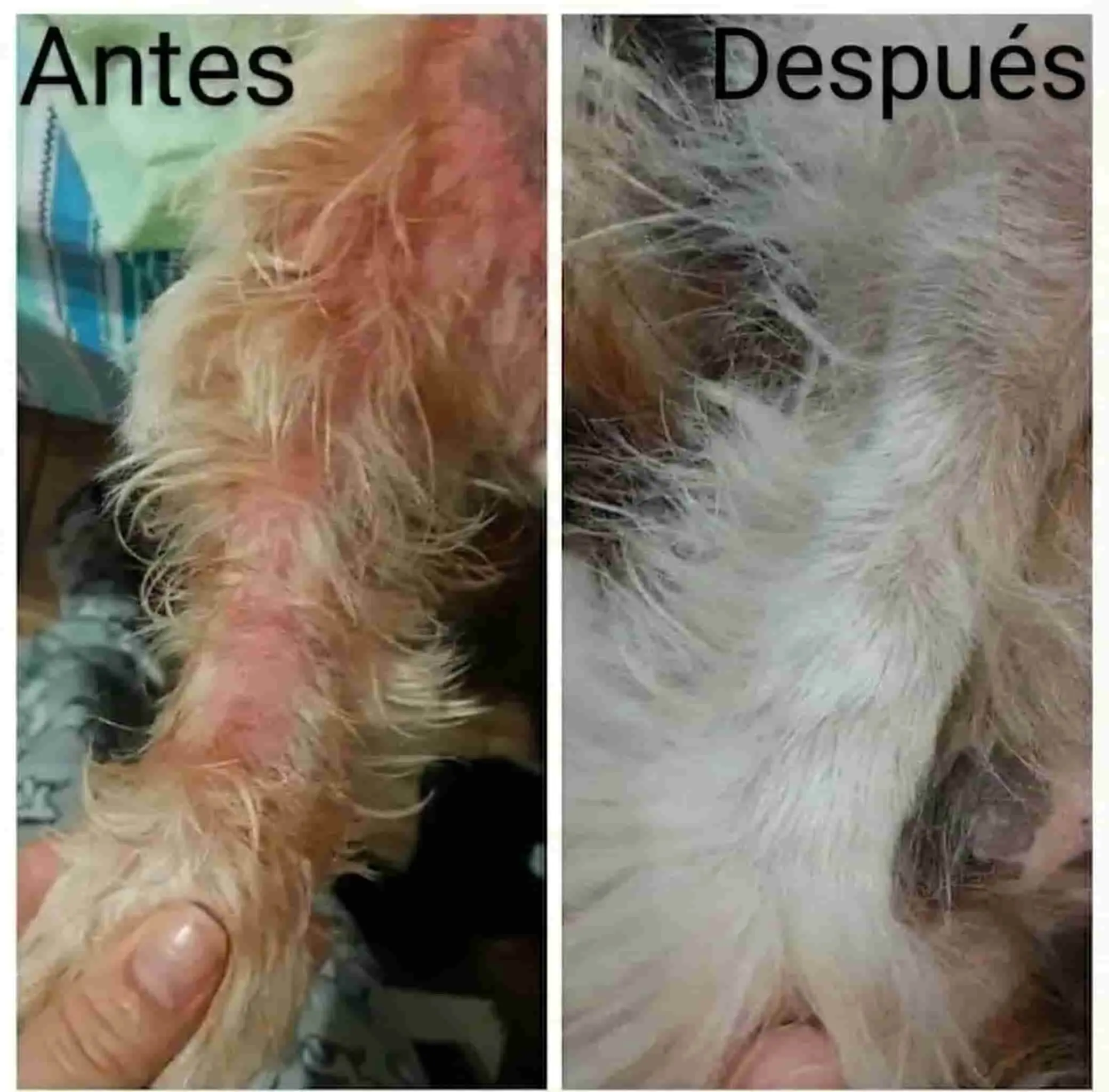 Transformación real - Dermatitis en el cuello completamente curada